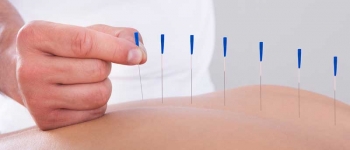 Meis Acupuncture