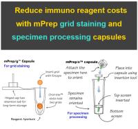 mPrep Immuno Grid Staining & Specimen Processing. Saving valuable reagents 