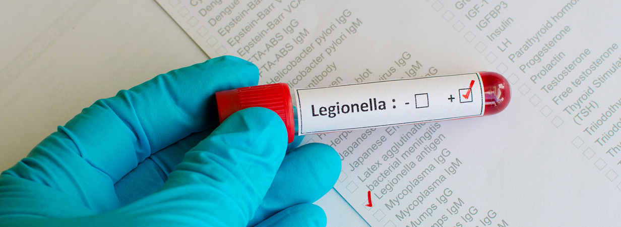 Legionella Control Services For Businesses UK