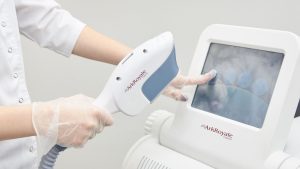 Advanced IPL System Leasing Options