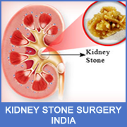 Affordable Urethroplasty Surgery in India