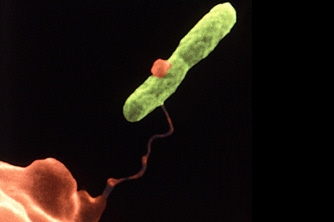Legionella Pneumophila Risk Assessment Testing