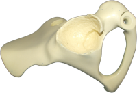 Polyurethane Skeleton For The Medical Industry