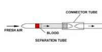 290CN HYDROGEN CYANIDE IN BLOOD