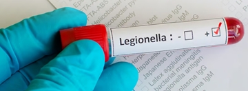 Legionella Risk Assessments Winchester