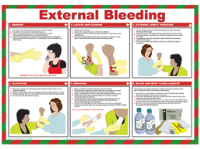 External bleeding treatment guide.