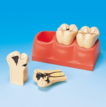 Tooth Disease Models