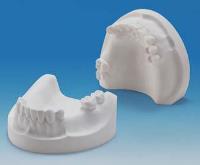 Plaster Jaw Models