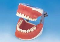 Oral Surgery Jaw Model